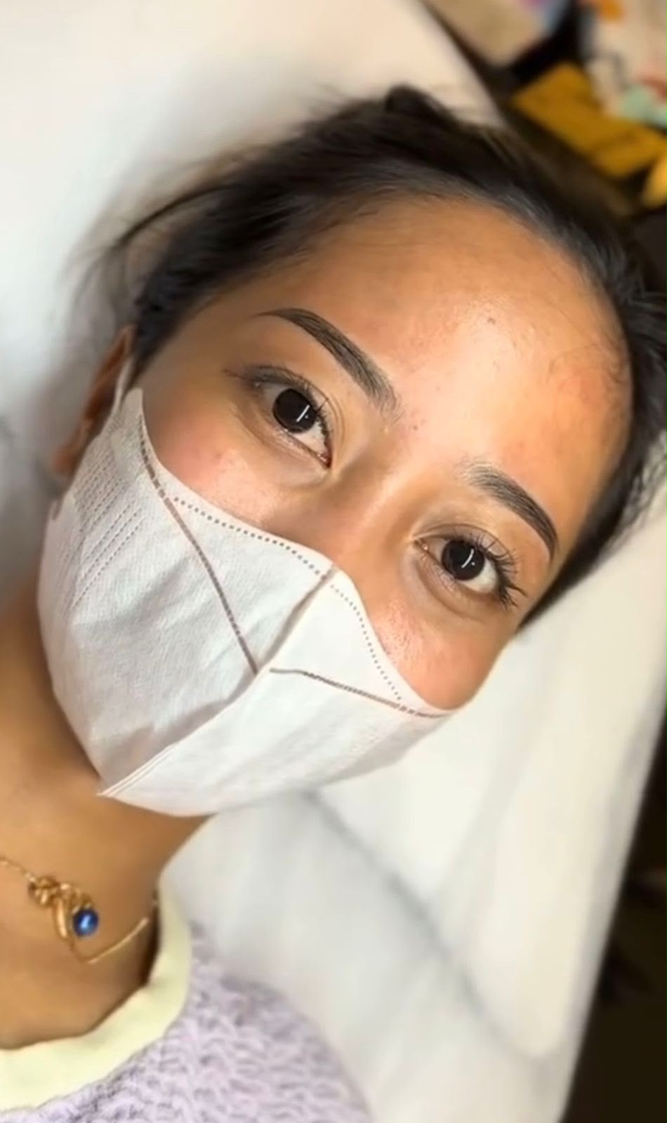 Professional brow results detail