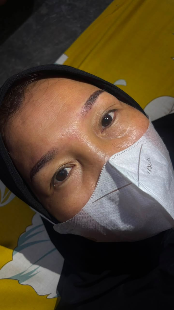 Natural beauty treatment results by Ica