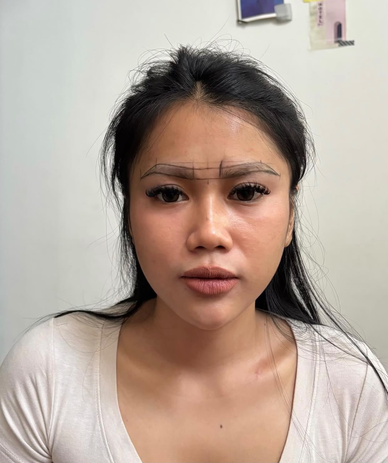 Before Eyebrow Treatment by Ica